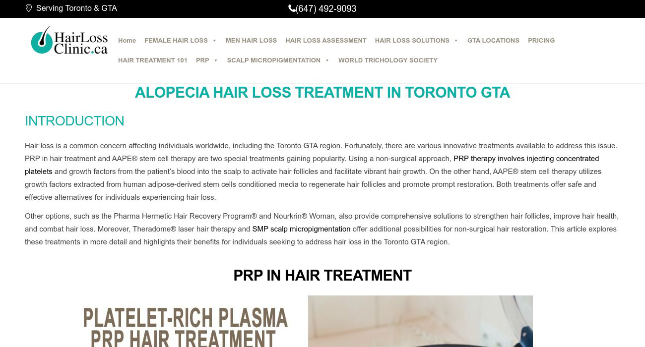 HAIR LOSS CLINIC TORONTO