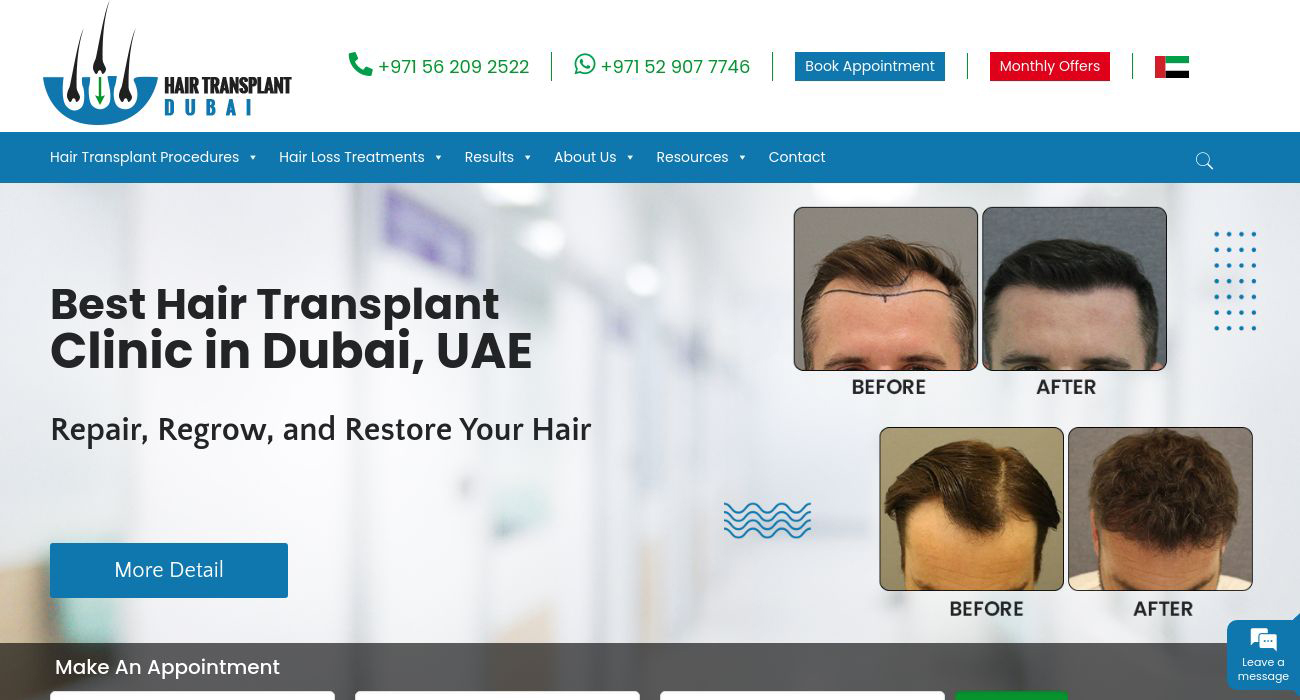 Hair Transplant Dubai Clinic