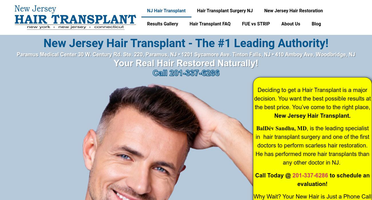 New Jersey Hair Transplant