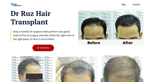 Dr Ruz Hair Transplant