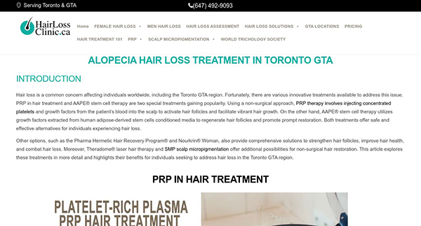 HAIR LOSS CLINIC TORONTO