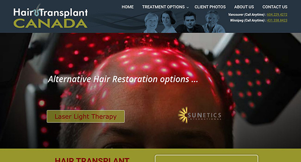 Hair Transplant Canada