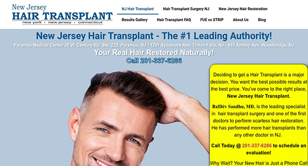 New Jersey Hair Transplant